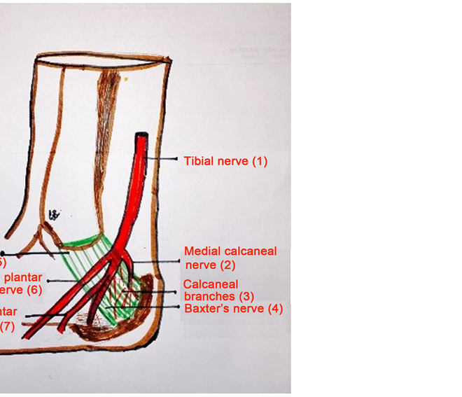 Tarsal Tunnel Syndrome: Causes, Symptoms, Diagnosis, and Treatment Options