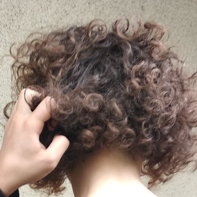 Hair Pulling Disorder (Trichotillomania): A Complete Guide