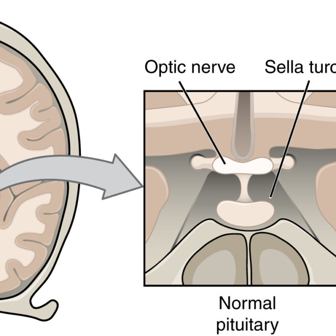 Pituitary Tumor: Overview, Types, Symptoms & Diagnosis
