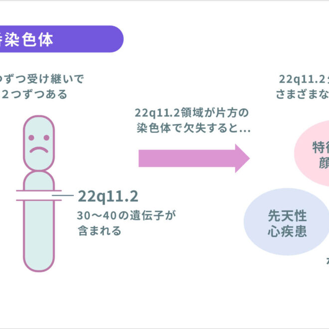 DiGeorge Syndrome (22q11.2 Deletion Syndrome): Overview, Symptoms, and Care