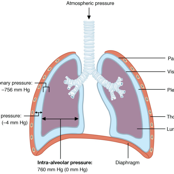 Collapsed Lung (Pneumothorax): Causes, Symptoms, Diagnosis & Treatment