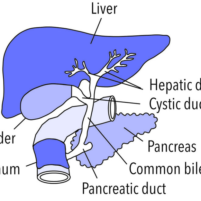 Gallstones: What They Are, Causes, Symptoms & Treatment