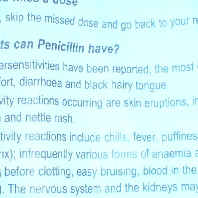 Black Hairy Tongue: Causes, Symptoms, and Care