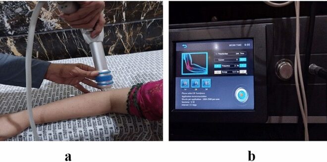 Tennis Elbow (Lateral Epicondylitis): Causes, Symptoms, and Treatments