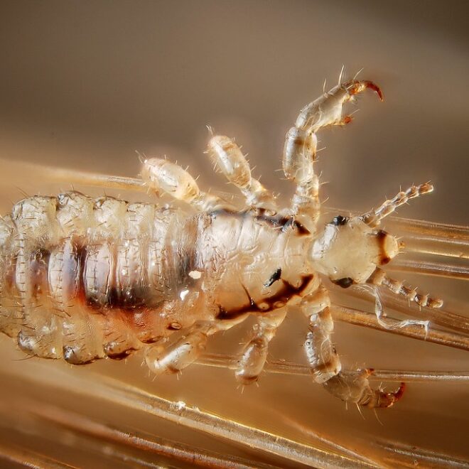 Head Lice: Causes, Symptoms, and Treatments