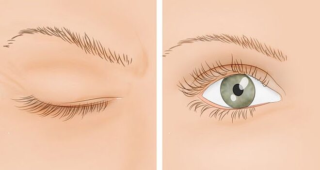 Eyelid Twitching: Causes, Symptoms, and Treatment Options