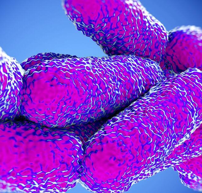 Legionnaires’ Disease: Causes, Symptoms, Diagnosis, and Treatment (Legionellosis)