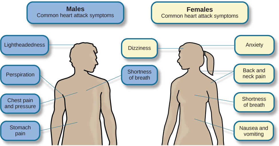 Heart Attack: Causes, Symptoms, Diagnosis, and Treatment