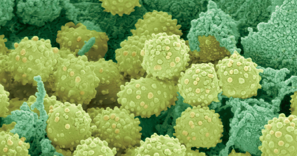 Hand Foot and Mouth Disease: Overview, Causes, Symptoms & Care