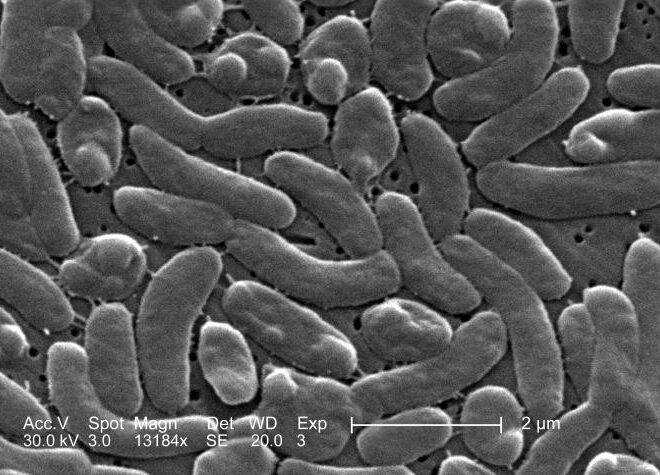 Cholera: Understanding the Disease, Its Causes, and Prevention