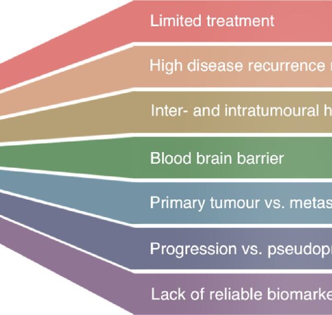 Brain Tumor (Glioma): Types, Causes, Symptoms, Diagnosis & Treatment