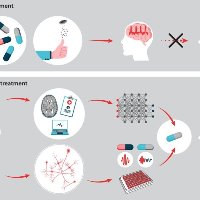 Epilepsy: Types, Triggers, and Treatments