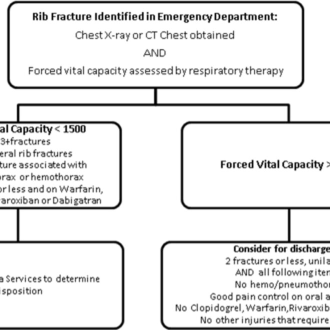Rib Fractures: Causes, Symptoms, Diagnosis, and Recovery