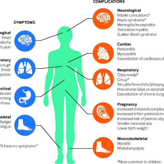 Influenza: What It Is, How It Spreads, Symptoms & Prevention