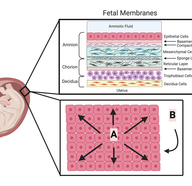 Preterm Birth: Understanding Causes, Risks, and Care