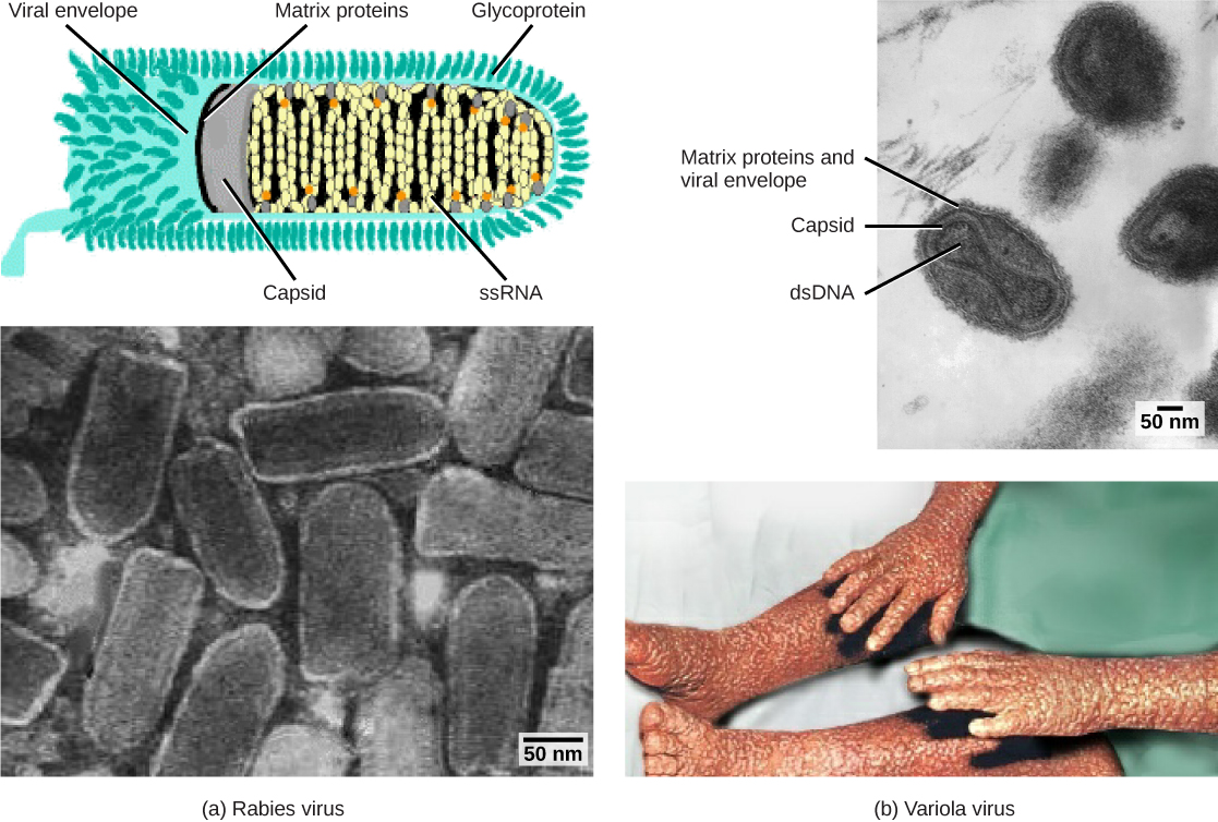 Rabies: What It Is, How It Spreads, and Why It's Dangerous