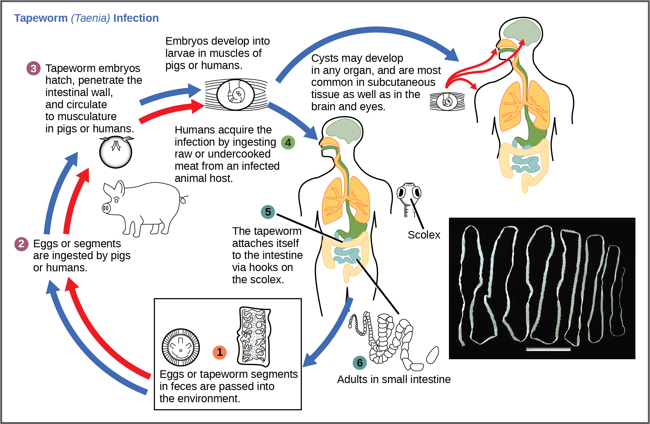 Tapeworm Infection (Intestinal Parasite): Causes, Symptoms, Diagnosis & Treatment