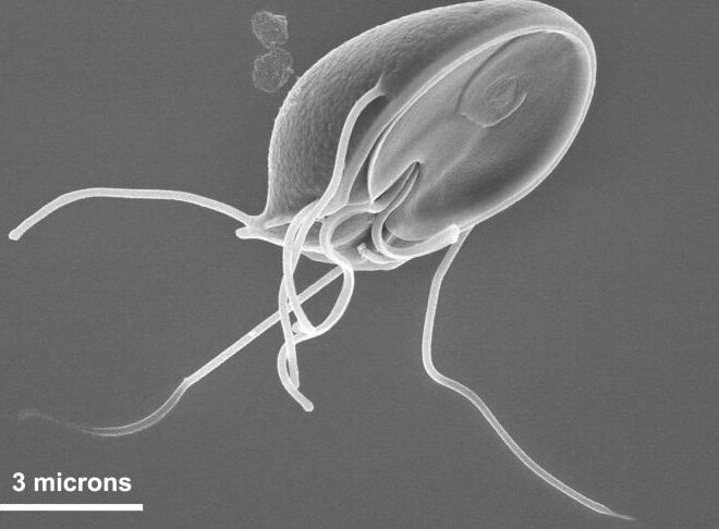 Giardiasis (Intestinal Parasite Infection): Overview, Causes, Symptoms & Treatments