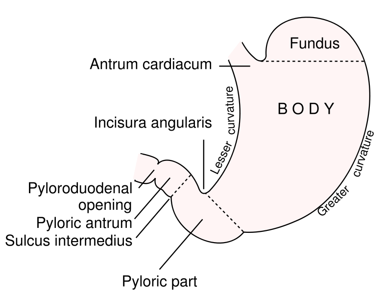 Pyloric Stenosis: Causes, Symptoms, Diagnosis, and Treatment (Narrowing of the Stomach Opening)