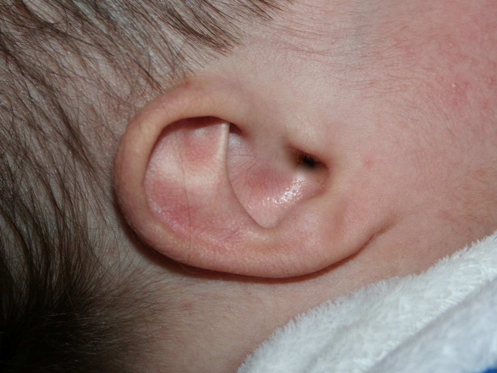 Inner Ear Infection: Causes, Symptoms, Diagnosis & Treatments