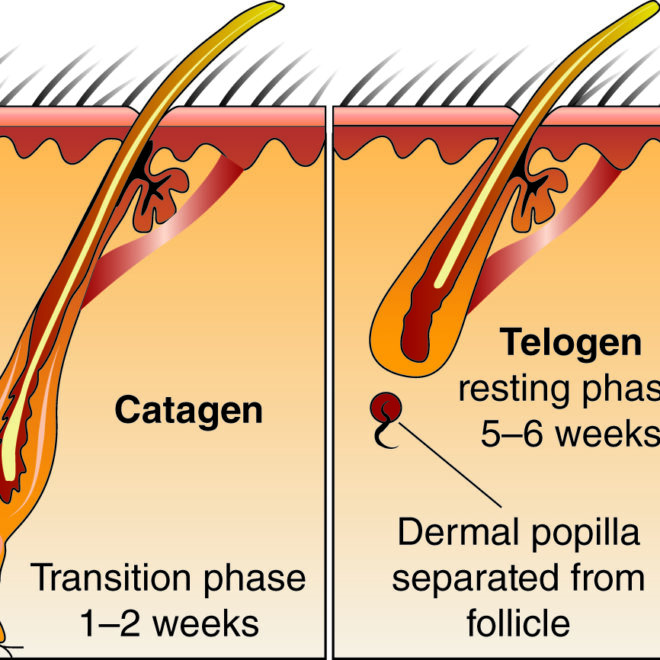 Dandruff: Causes, Symptoms, and Treatments Explained