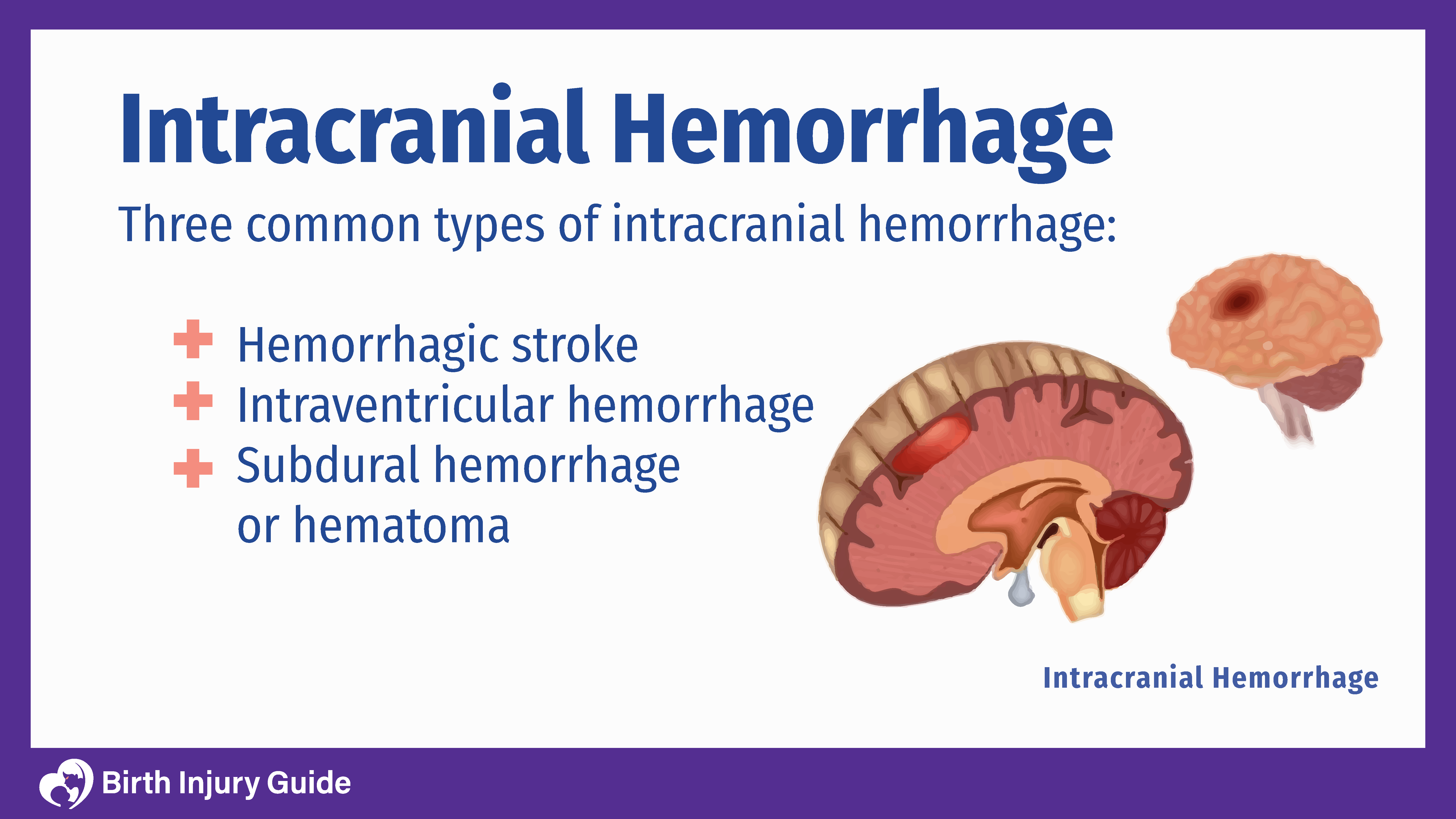 Bleeding in the Brain (Intracerebral Hemorrhage): Causes, Symptoms & Care