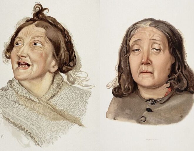 Cyclothymia (Chronic Mood Disorder): Overview, Symptoms, Diagnosis & Management