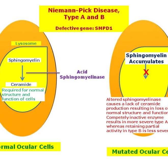 Niemann-Pick Disease: Understanding the Rare Genetic Disorder