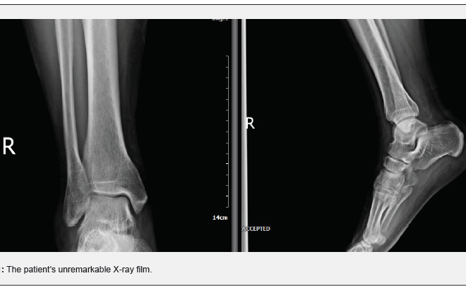 Tenosynovitis: Causes, Symptoms, Diagnosis, and Treatment Options
