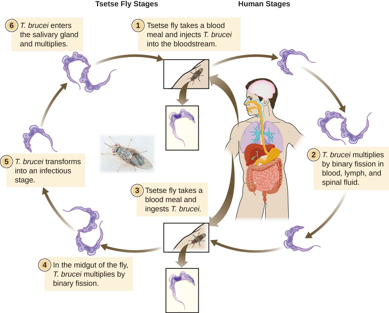 Chagas Disease (American Trypanosomiasis): Causes, Symptoms, Diagnosis, and Treatment