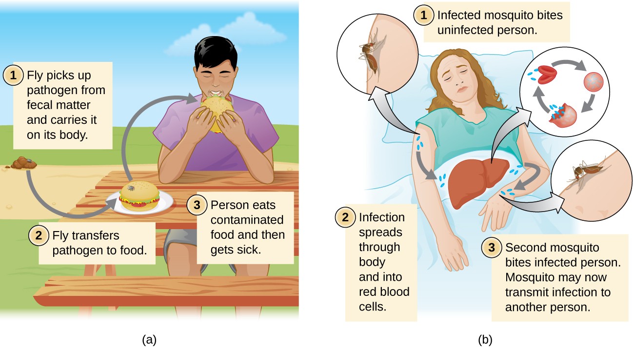 Typhoid Fever: What It Is, Causes, Symptoms & Treatment
