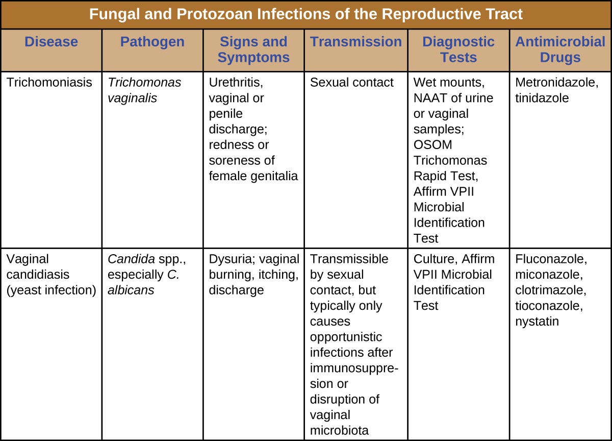 Trichomoniasis: Causes, Symptoms, Diagnosis, and Treatment (Sexually Transmitted Infection)