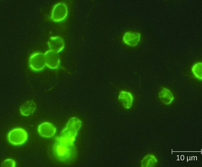 Cryptosporidiosis (Crypto): Causes, Symptoms, Diagnosis & Prevention
