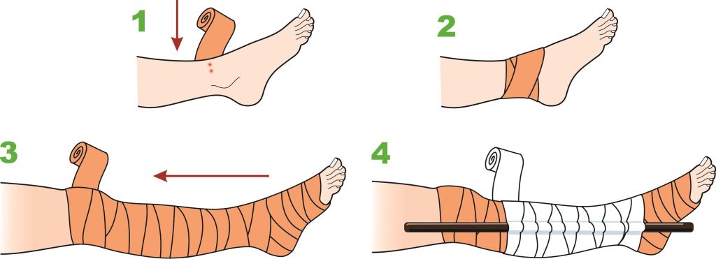 Snake Bite: Types, Symptoms, First Aid, and Treatment Options