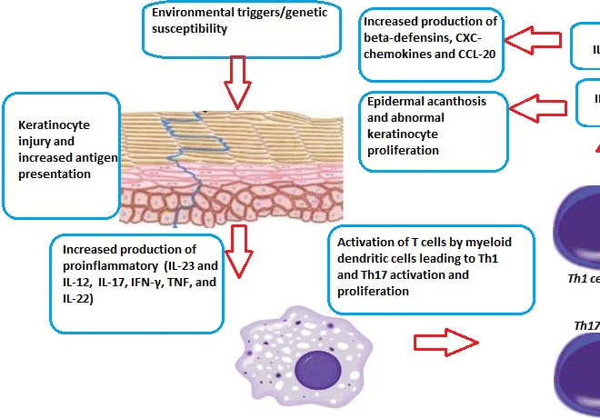 Psoriasis: Understanding the Skin Condition, Its Triggers, and Treatments
