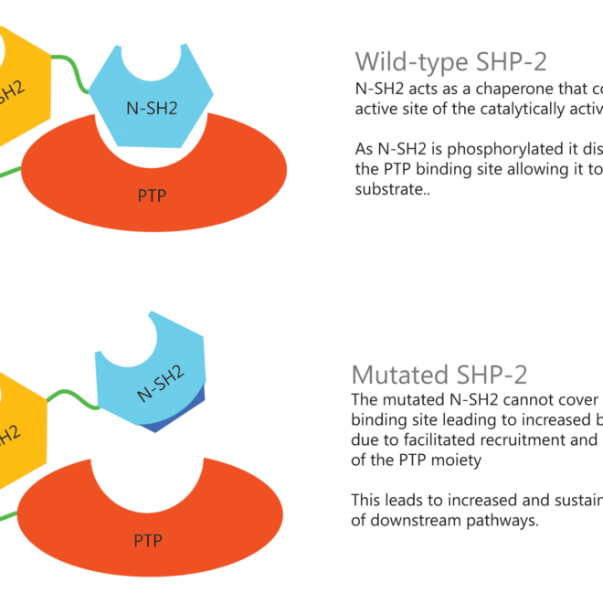 Noonan Syndrome: Causes, Symptoms, Diagnosis, and Treatment