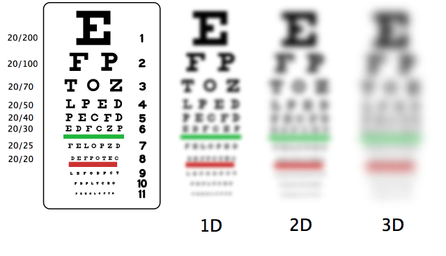 Nearsightedness (Myopia): Causes, Symptoms, and Solutions