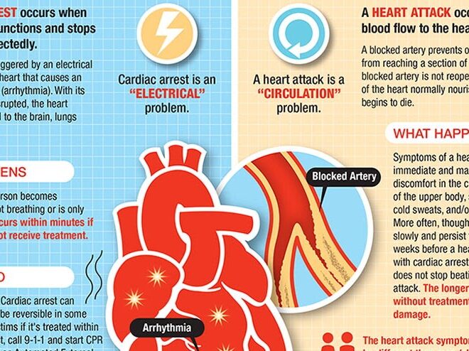 Heart Attack: Causes, Symptoms, Diagnosis, and Treatment
