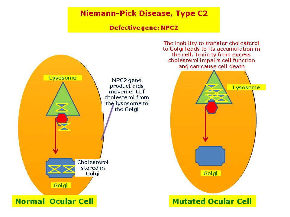 Niemann-Pick Disease: Understanding the Rare Genetic Disorder