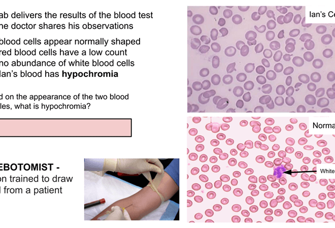 Thalassemia: Types, Causes, Symptoms, and Treatments