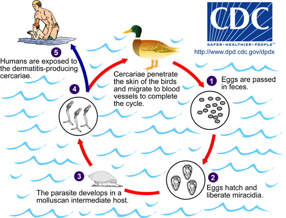 Swimmer's Ear (Outer Ear Infection): Causes, Symptoms & Care