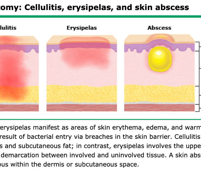 Cellulitis: Causes, Symptoms, and Treatments