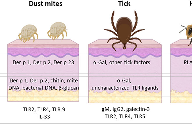 Dust Mites Allergy: Causes, Symptoms, Diagnosis, and Treatment