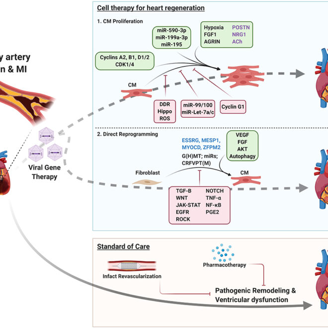 Ischemic Cardiomyopathy: Overview, Causes, Symptoms, and Treatments