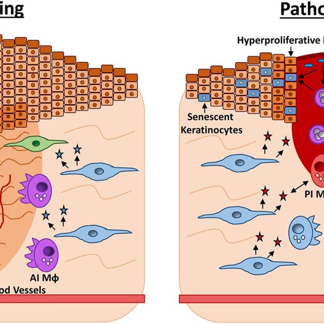 Chronic Wounds: Types, Causes, and Healing Process