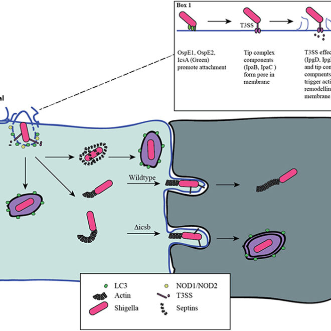Shigellosis: Causes, Symptoms, Diagnosis, and Treatment (Bacillary Dysentery)