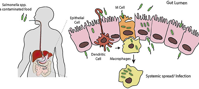 Salmonella Infection (Salmonellosis): Causes, Symptoms, and Prevention