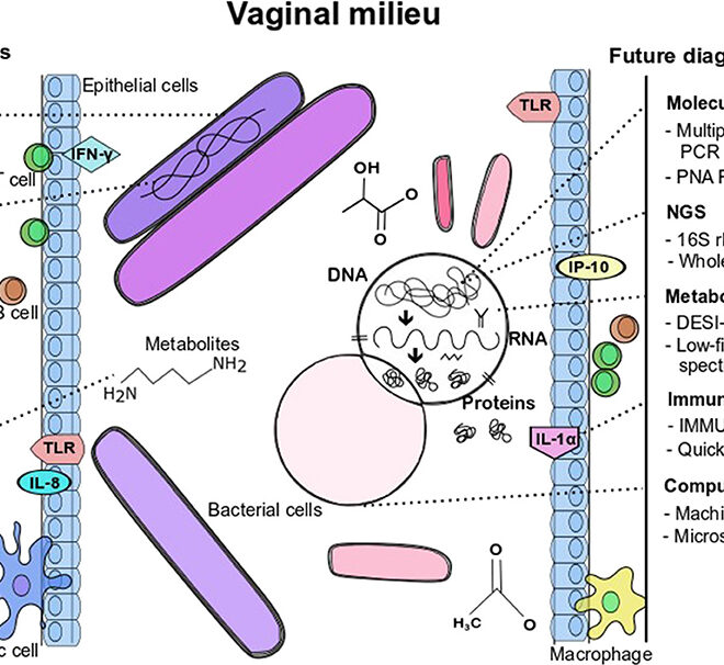 Bacterial Vaginosis: Causes, Symptoms, Diagnosis, and Treatment