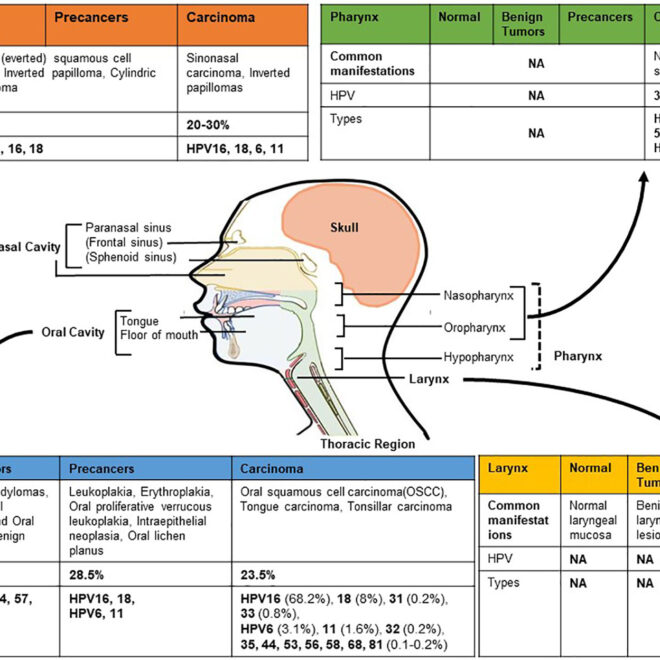 Nasopharyngeal Cancer (NPC): Overview, Causes, Symptoms & Treatments