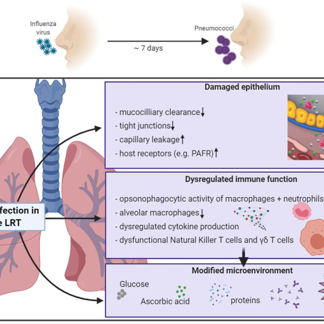 Pneumonia: What It Is, Causes, Symptoms & Treatment